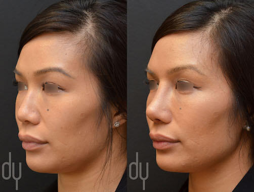 Gallery | Beverly Hills Facial Plastic Surgery - Donald B. Yoo M.D.