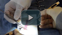 Making DCF - Suturing only