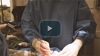 Rhinoplasty Osteotomy Video
